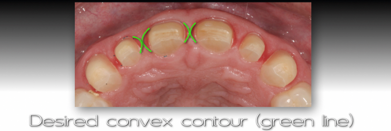 Desired convex contour.