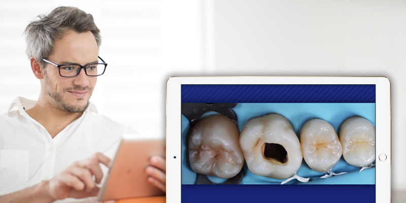 man on an ipad in the forefront, a closeup inset of an ipad with 4 molars on the screen.