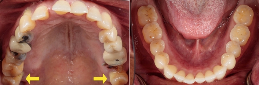 maxillary and mandibular view of teeth