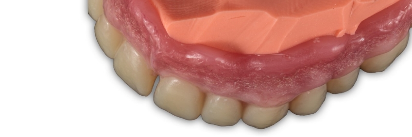 close up of maxillary denture showing flange with laboratory silicone removed