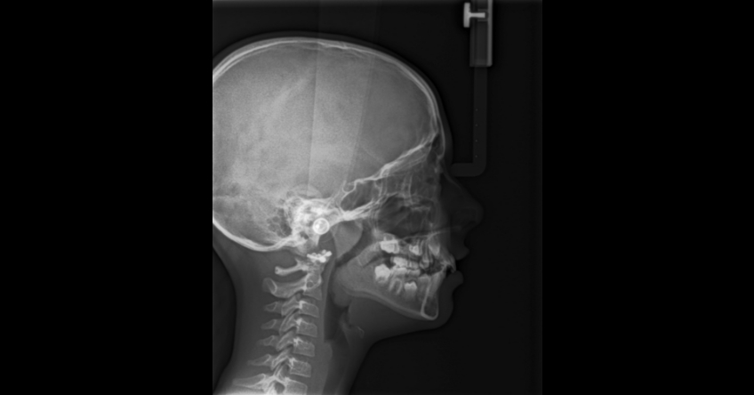 x-ray of human head and neck