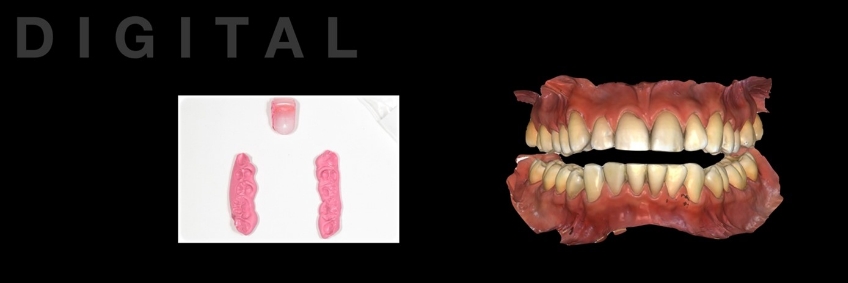 bite record (left), digital scan of teeth (right)