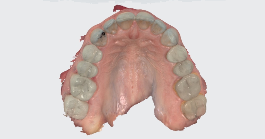 Example of a correct scan from patient in Figure 2.