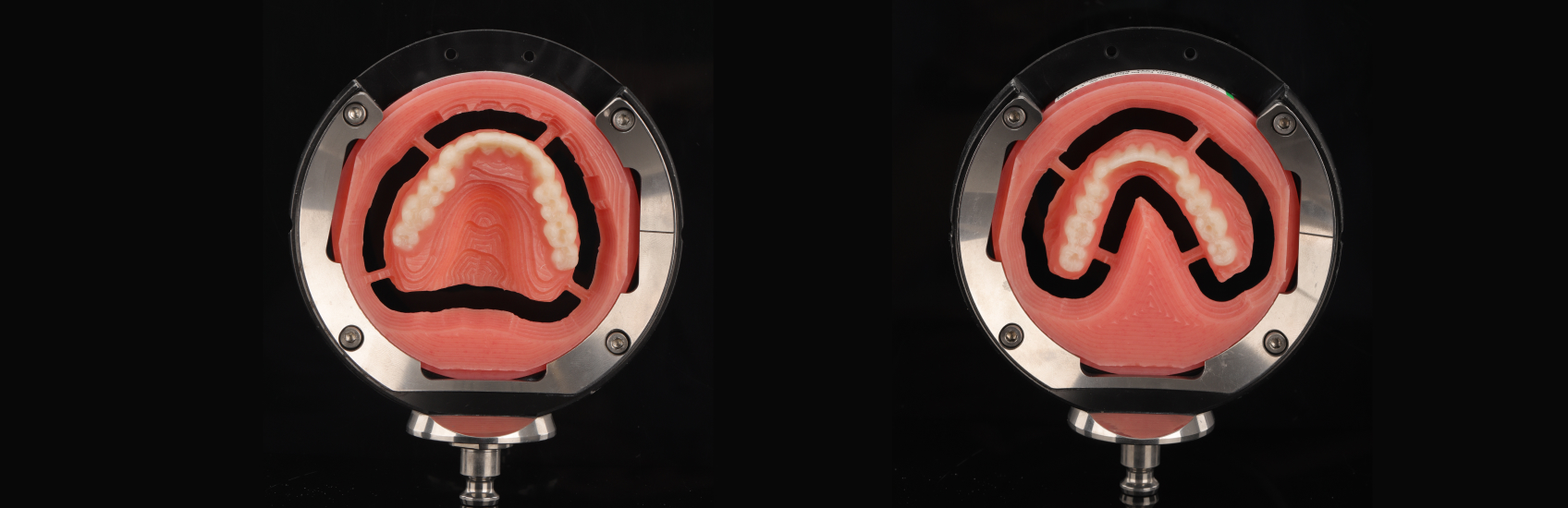 The oversized milling process for the upper and lower dentures