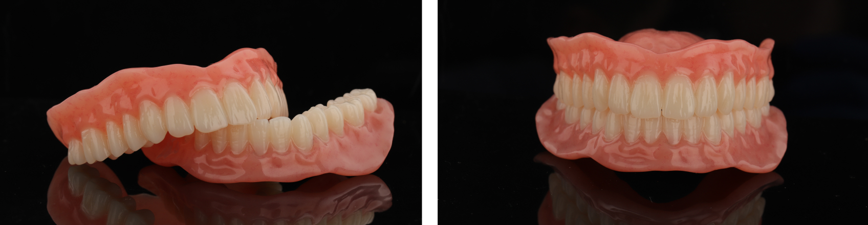 The patient's final, polished restorations.
