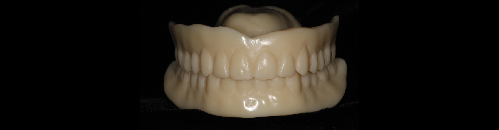 The denture duplication 3D-printed at the lab, 400 kilometers away, using data from the scan.