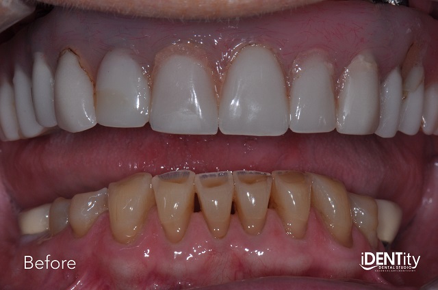 esthetic treatment dental