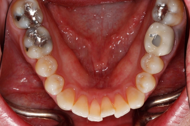 dental photography tips figure 1