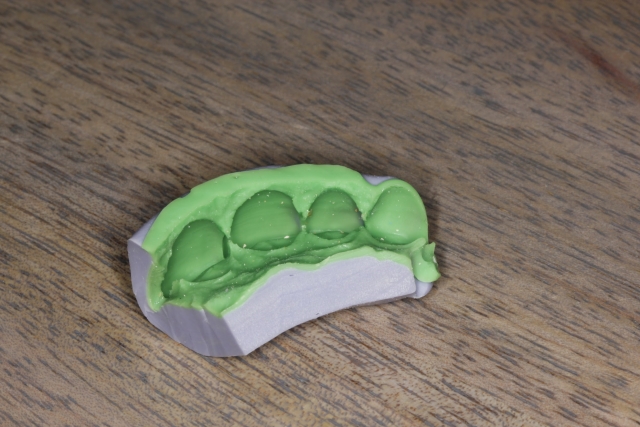 intraoral mock-up figure 8