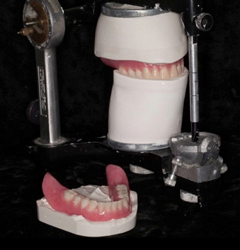 clinical remount of dentures