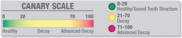 the canary scale