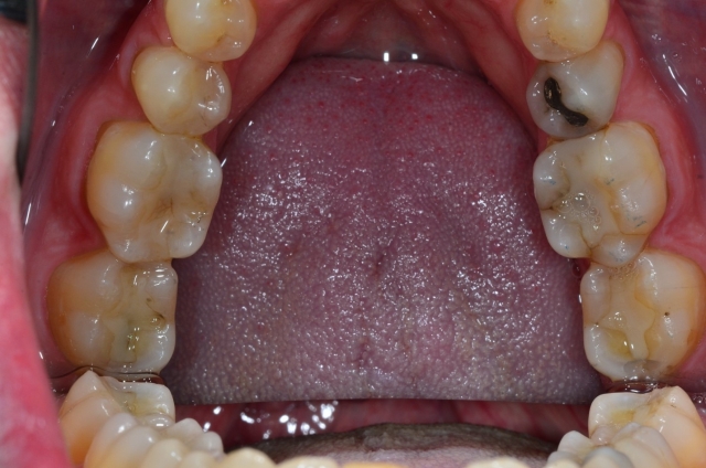 dental treatment planning figure 10