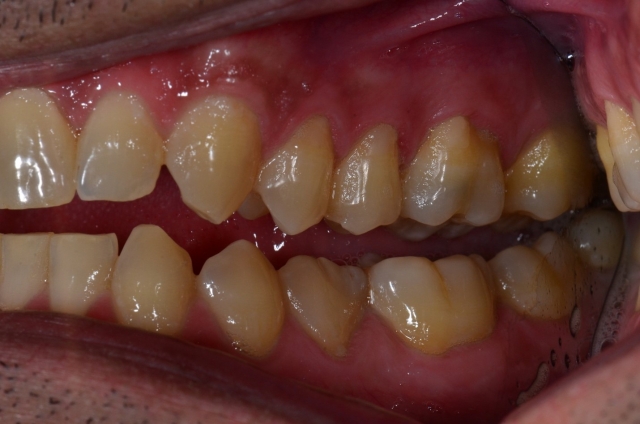 dental treatment planning figure 15