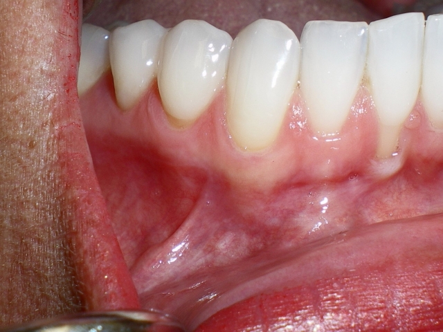 dental treatment planning figure 3