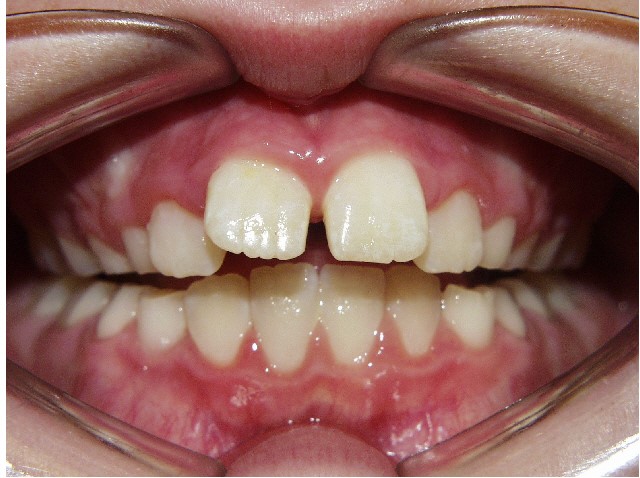 occlusion checklist figure 3