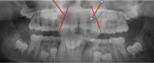 occlusion checklist figure 9