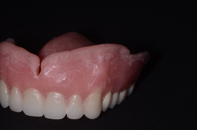 soft denture liners figure 5