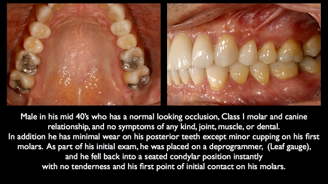 muscle reprogramming dentistry