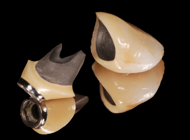 implant abutment figure 004