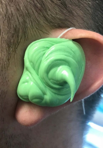 impression material in ear dental