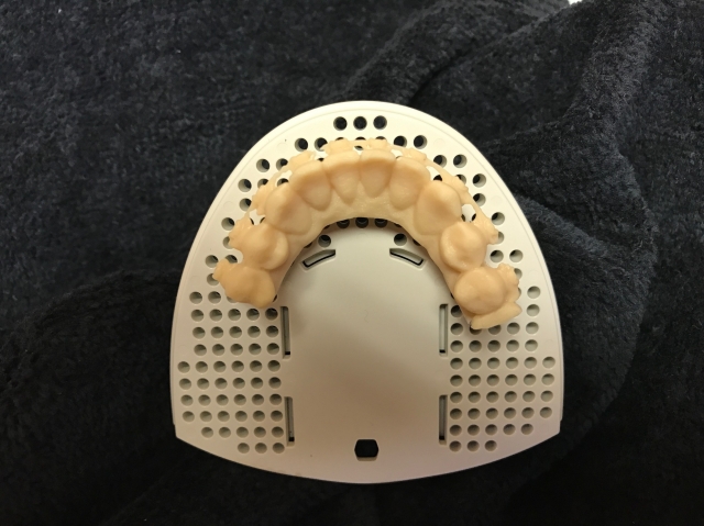 virtual orthodontic impressions