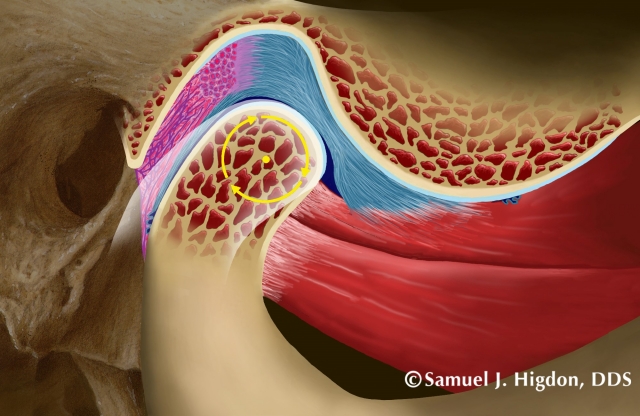 tmd diagnosis figure 5