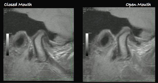 tmd diagnosis figure 16