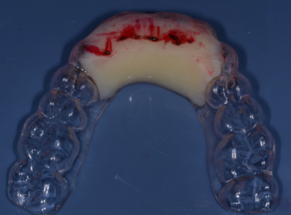 tmd diagnosis figure 18