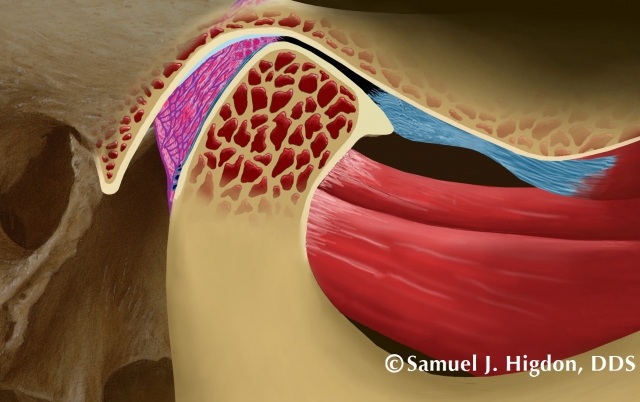 tmd diagnosis figure 22