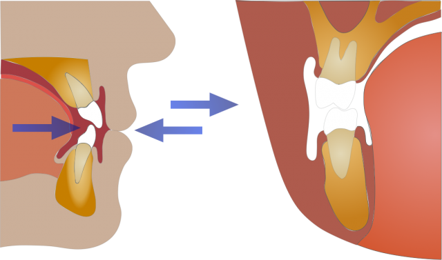 adolescent jaw growth development