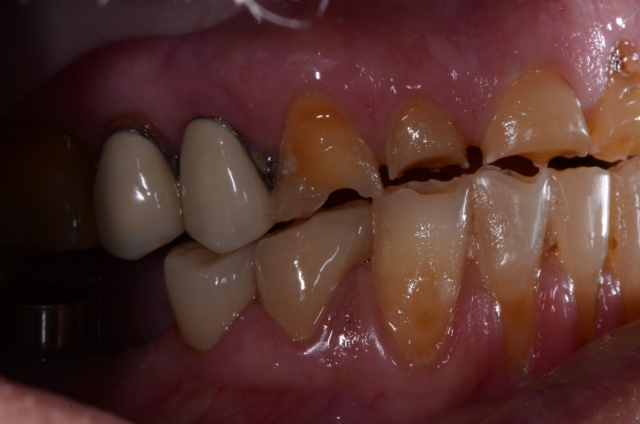 proarch patient figure 4