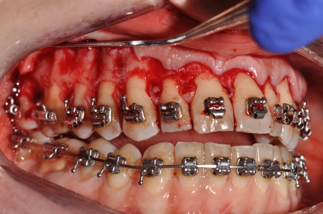 orthodontics figure 5