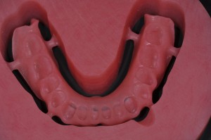 Close up of the molded denture with indents for each tooth to fit into.