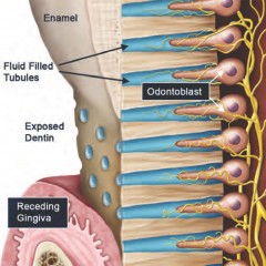 Dentinal tubules image copy