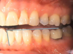 Step 6: Grey line along bottom side of teeth.