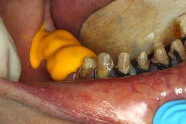 How to Take a Full Arch Impression on a Difficult Patient