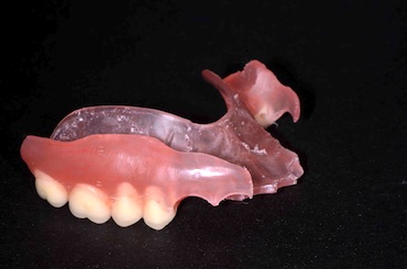 fixed partial denture all metal