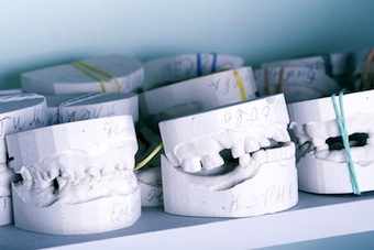 Teeth-Models