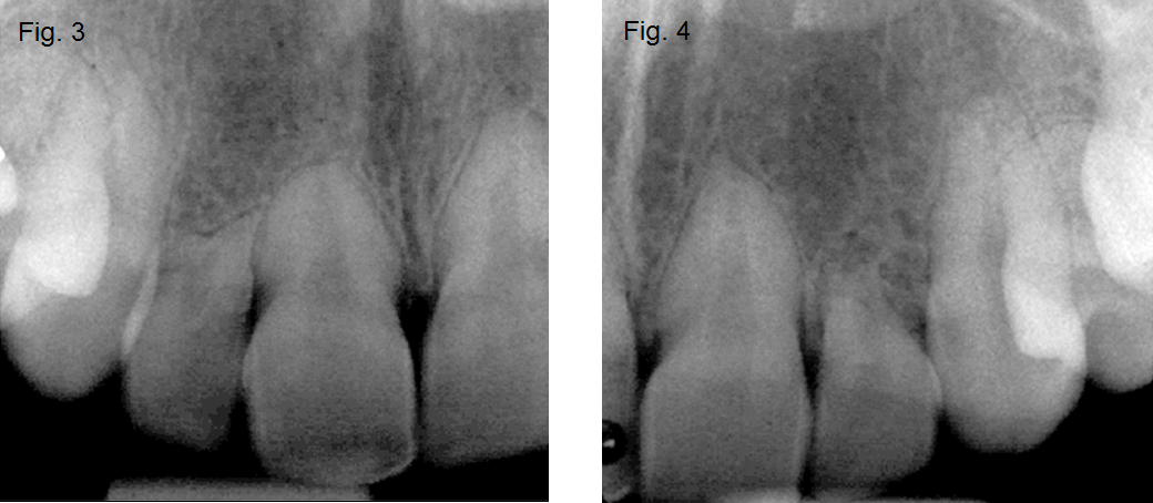 fig3_4