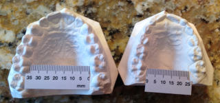 airway and dentistry figure 5