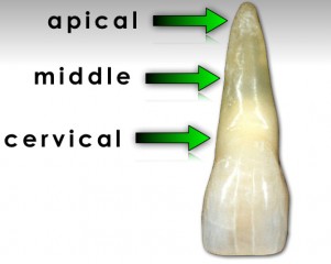 Root-Fracture